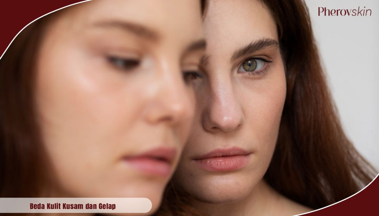beda kulit kusam dan gelap
