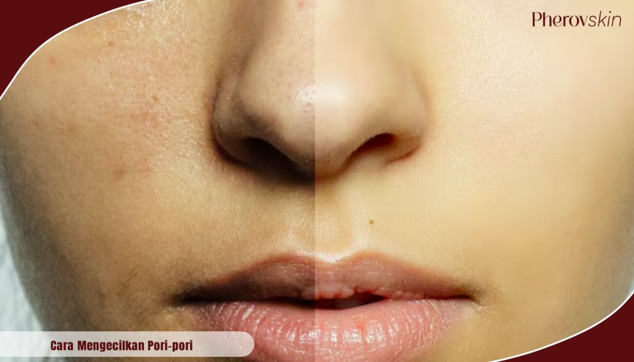 cara mengecilkan pori pori