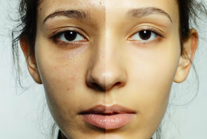 beda kulit kusam dan gelap