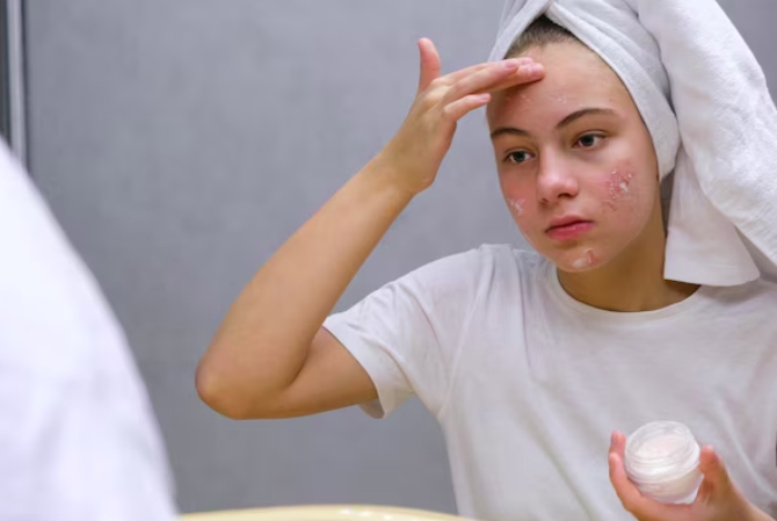 langkah terbaik mengatasi flek hitam