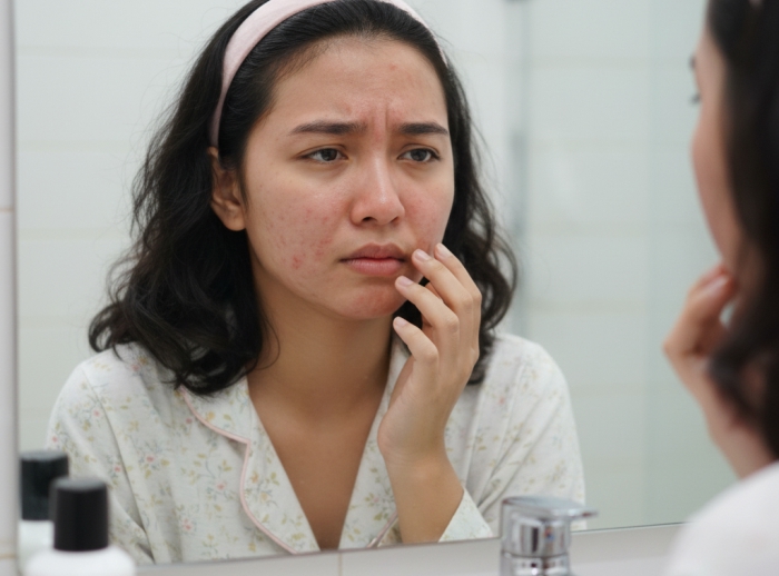 efek samping penggunaan retinol
